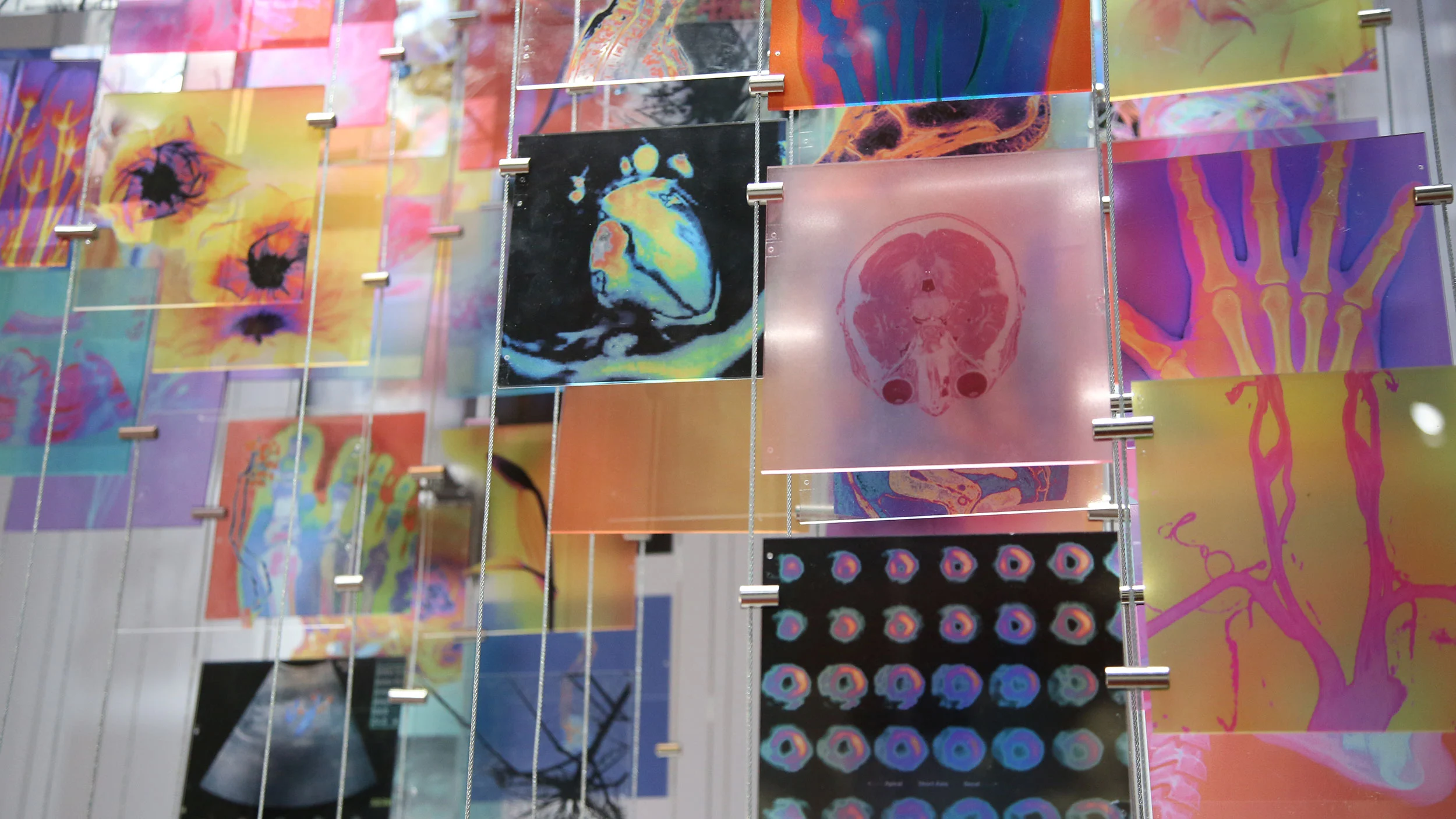 Dettaglio di scansioni mediche colorate stampate su pannelli di vetro sospesi – Bracco The Beauty of Imaging, Milano, Italia, 2017 – allestimento espositivo